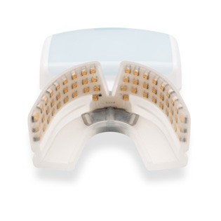 Dr. Fricke: OrthoPulse© Brackets