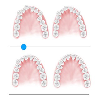 Terminart ClinCheck®