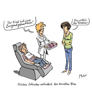 Frontal offener Biss
