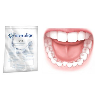 Aufklärungsbogen - Invisalign